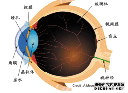 義眼適合什么樣的患者？